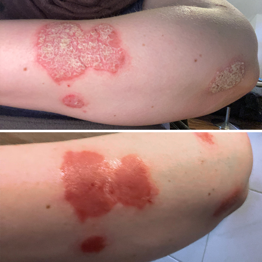 ERFAHRUNGSBERICHT NINA