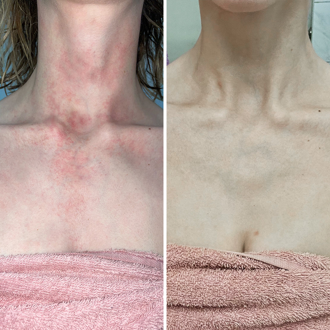 ERFAHRUNGSBERICHT ALICIA