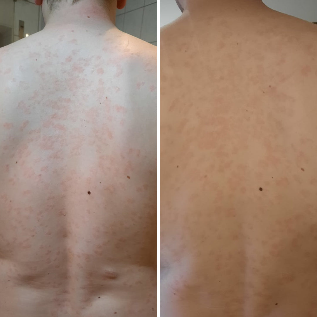 ERFAHRUNGSBERICHT MARTIN