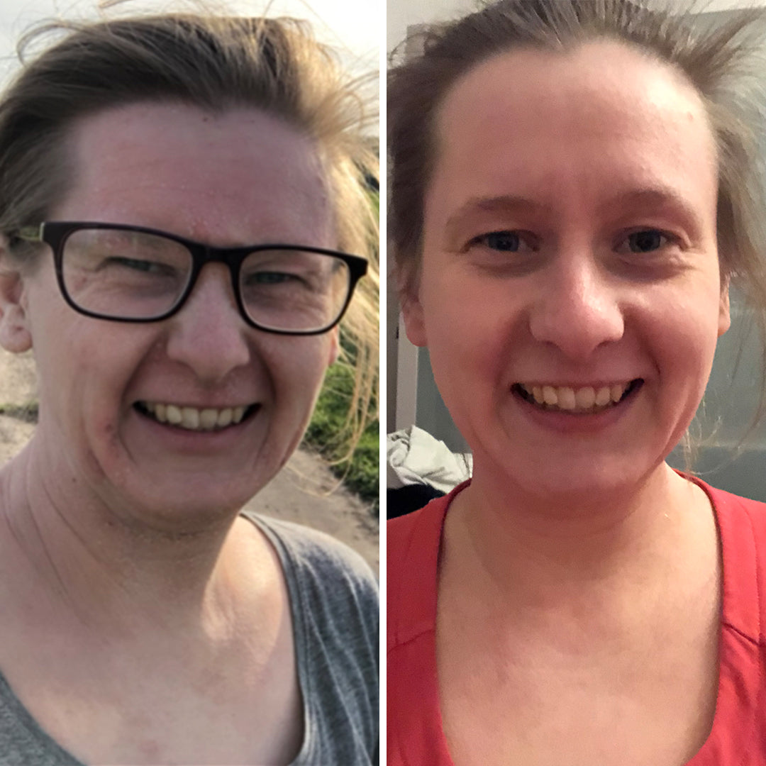 ERFAHRUNGSBERICHT PATRICIA