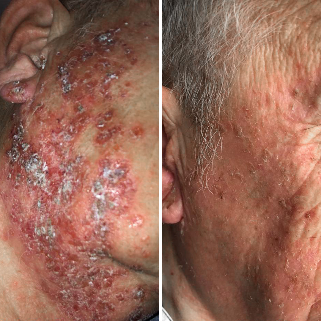 ERFAHRUNGSBERICHT WALTER