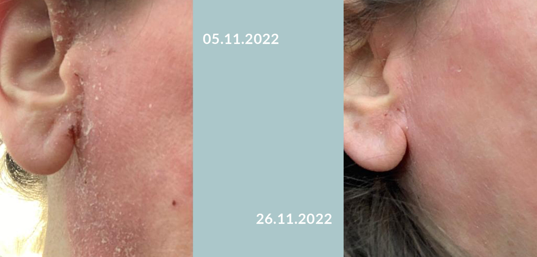 ERFAHRUNGSBERICHT CLAUDIA