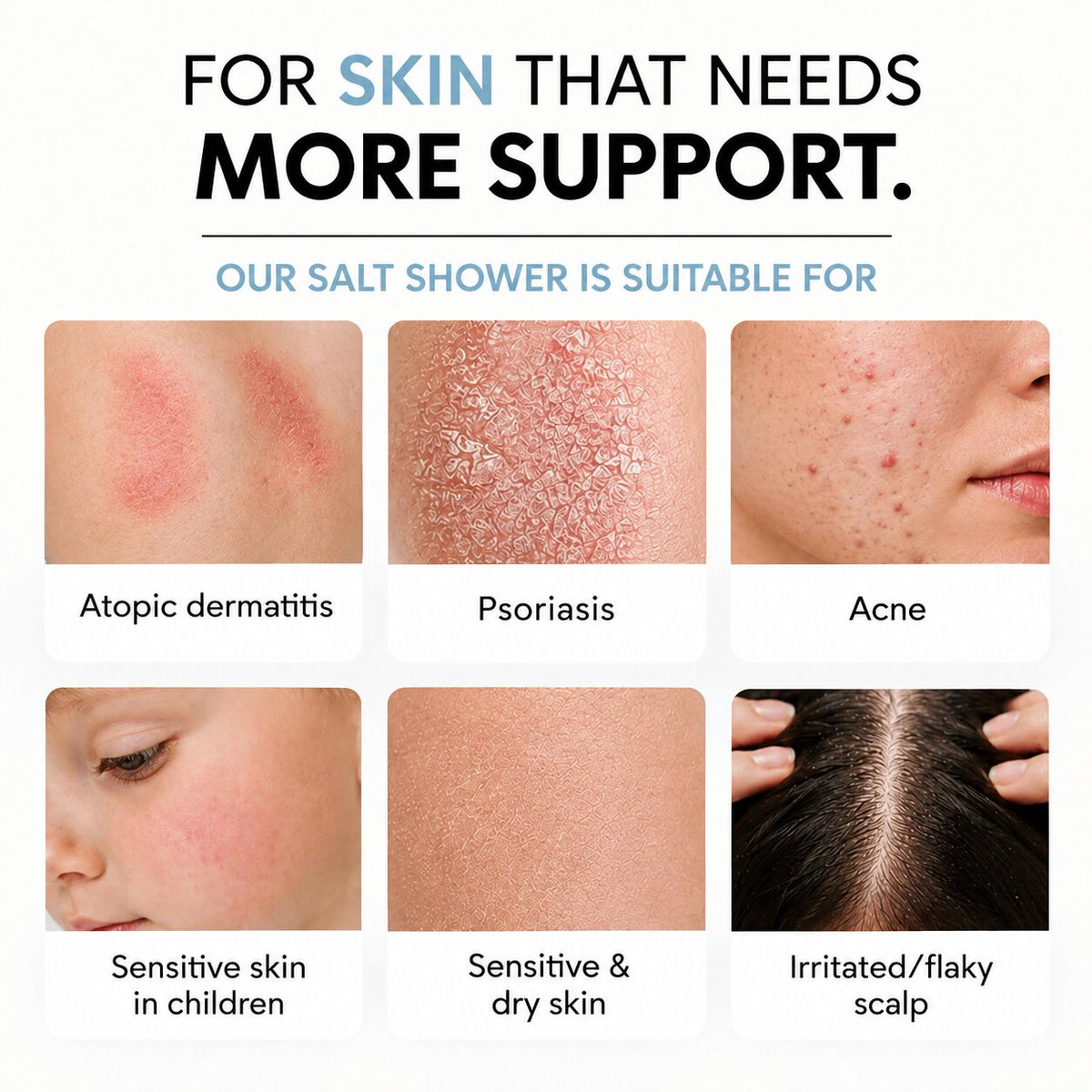 Forskinthatneedsmoresupport